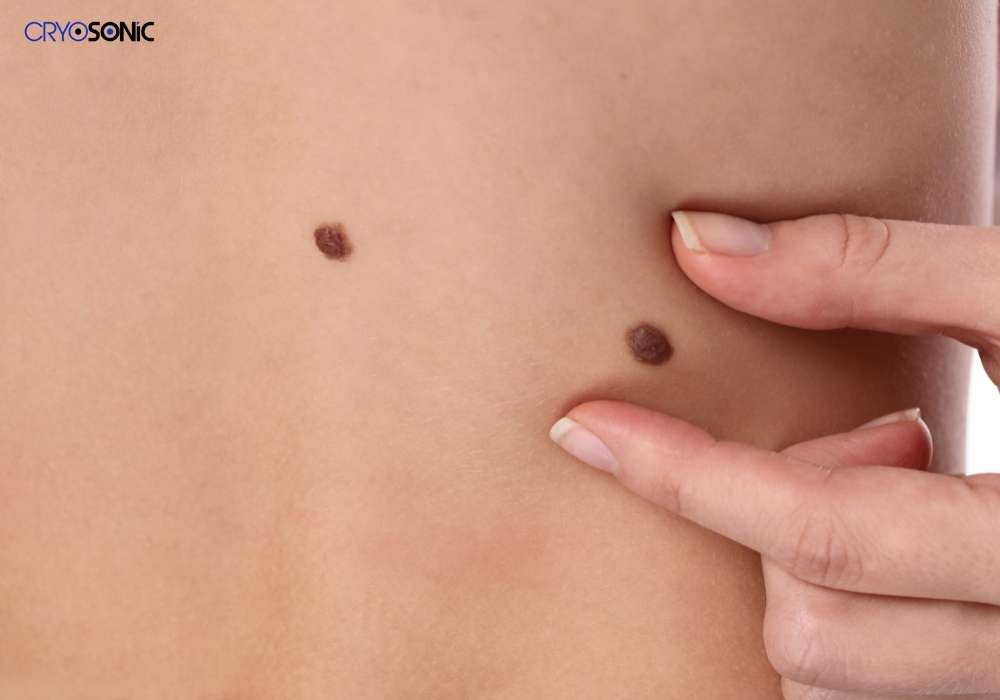 Infection Risk and Poor Aftercare Gloucester